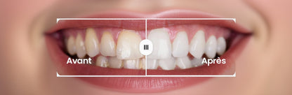 Bande de Blanchiment Optique PAP+ (Zéro Sensibilité)